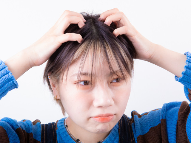 頭皮がかゆくてフケも気になる 原因を見極めて対処せよ 髪のプロが指南 ヘアのお悩み一問一答vol 16 美的 Com