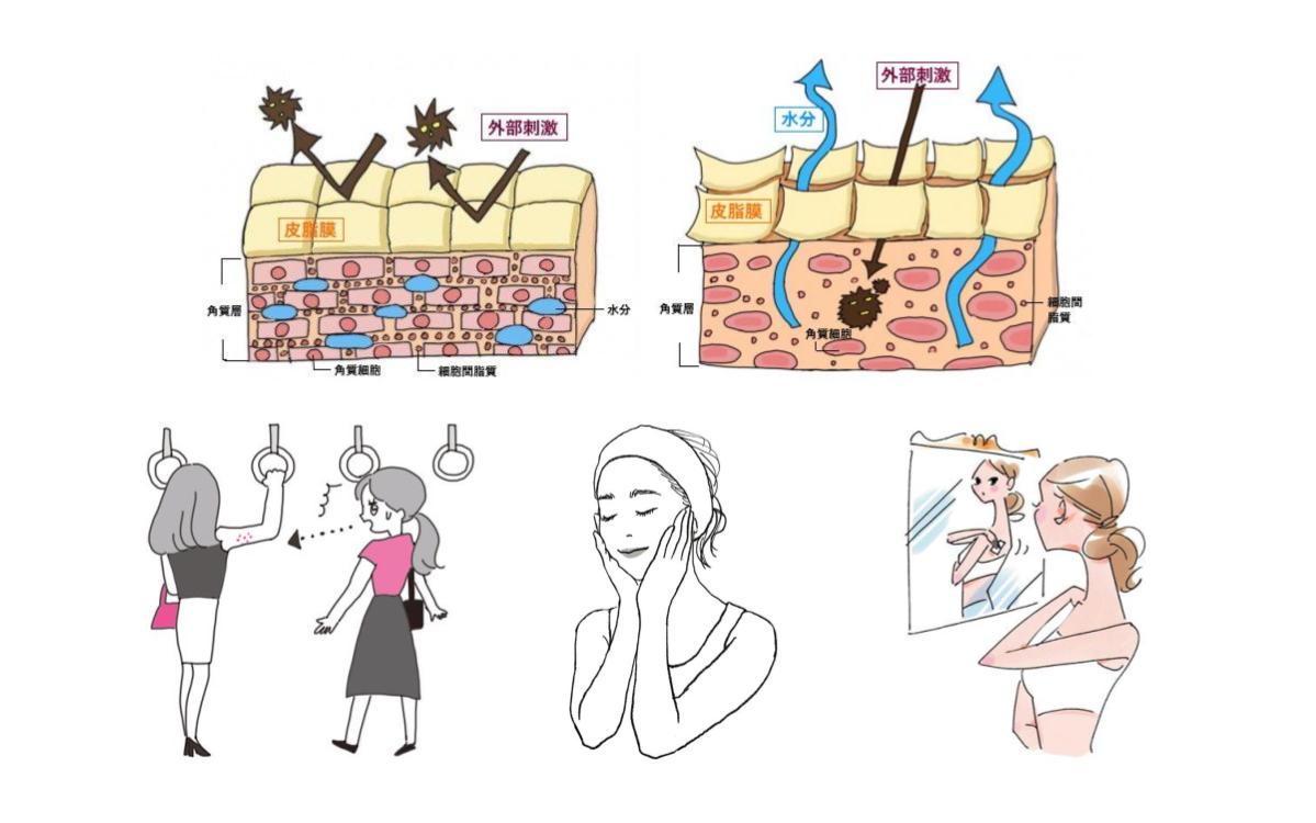 肌荒れ 顔 二の腕 背中など ブツブツができる 原因 と 治し方 美的 Com