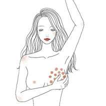 【乳がん】早く見つければ怖くない！検診は自分の体を守る、始めの一歩｜美的GRAND