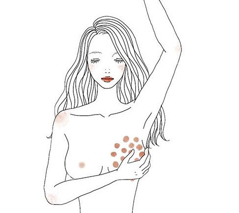 【乳がん】早く見つければ怖くない！検診は自分の体を守る、始めの一歩｜美的GRAND
