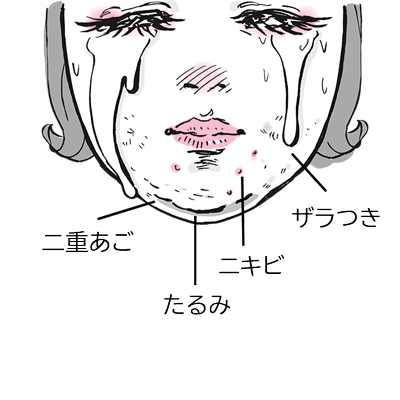 二重あごやニキビ…あごのトラブルを解消！ キレイを底上げしてくれる習慣とは？
