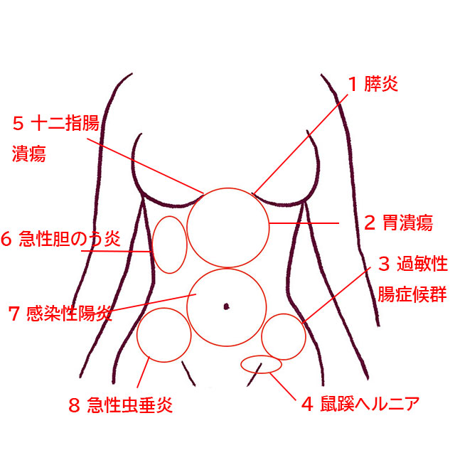 腹痛は体内のトラブルからのsos！？ 痛むパーツからのサインを見落とさずに適切な受診を！ 美的com 