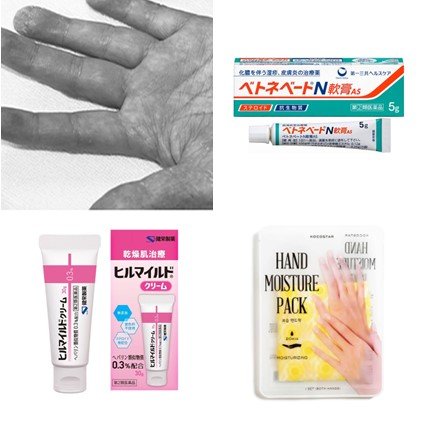 手の乾燥がひどいと、どうなる？「原因」と「対策」まとめ