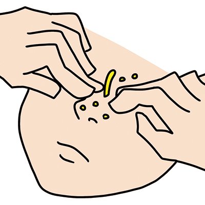 毛穴に良くないお手入れは？ 角栓ケアにオイルクレンジングはOK？｜毛穴のスペシャリストが疑問に回答