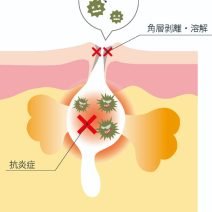 サリチル酸｜化粧品として、どんな効果が？【美容成分大全】