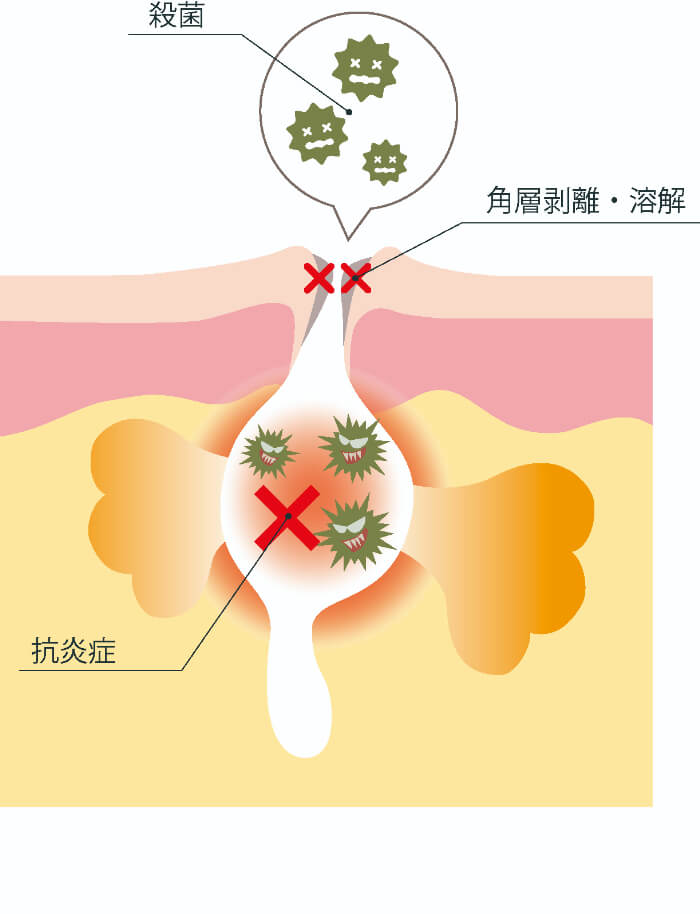 サリチル酸｜化粧品として、どんな効果が？【美容成分大全】