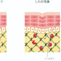 【ニールワン】日本初の「しわ改善」有効成分
