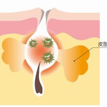 塩酸ピリドキシン｜化粧品としての効果は？【美容成分大全】