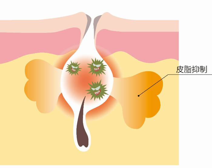 塩酸ピリドキシン｜化粧品としての効果は？【美容成分大全】