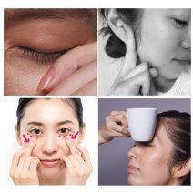 「目の腫れ」を治す方法は？7つの対処法＆予防テクを紹介