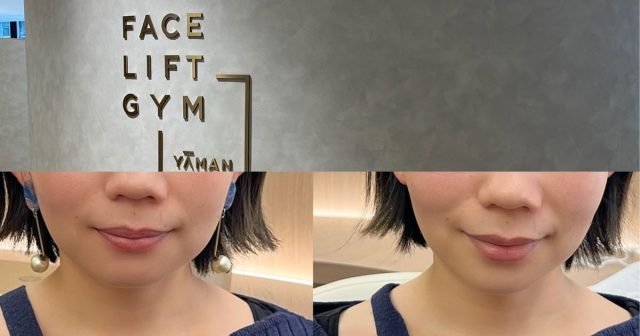 YA-MAN - メディリフト ヤーマン 新品 未開封 MediLift 表情筋 トレーニング メディリフト アクア EX | YA-MAN TOKYO JAPAN | ヤーマン株式会社