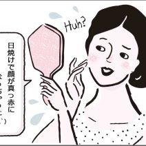 夏の肌トラブル【うっかり日焼け】の応急処置を美容のプロが伝授
