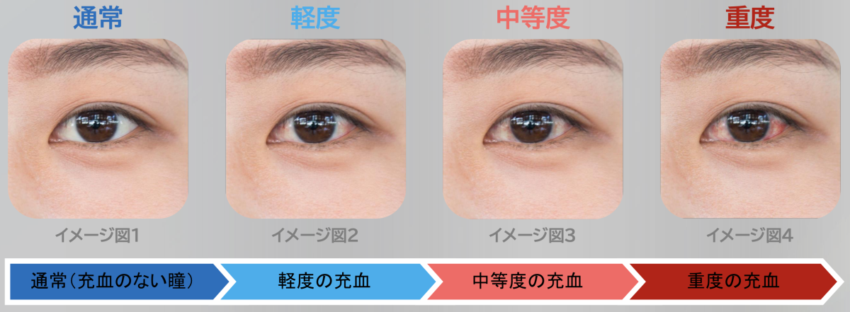 目の充血は見た目印象に影響を与えるってホント?真相を専門家に直撃!【美容の常識ウソ?ホント?】 | 美的.com
